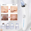 4-in-1 Facial Suction Blackhead Remover – Acne & Pore Cleaner | Elitecartt